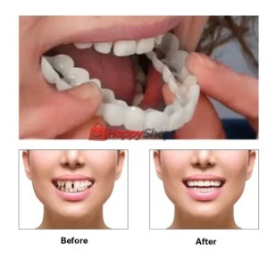 Изкуствени зъби протези WhiteSmile